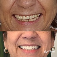 Depoimento Própolis Joice Silva