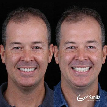 Depoimento Própolis Joice Silva