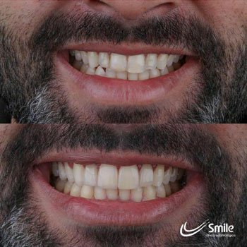 Depoimento Própolis Joice Silva